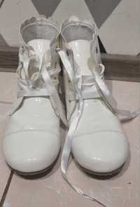 Білі ботинки лаковані