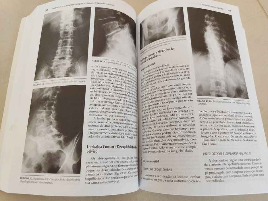 Livros Medicina: Reumatologia - Mário Viana de Queiroz (4 Volumes)