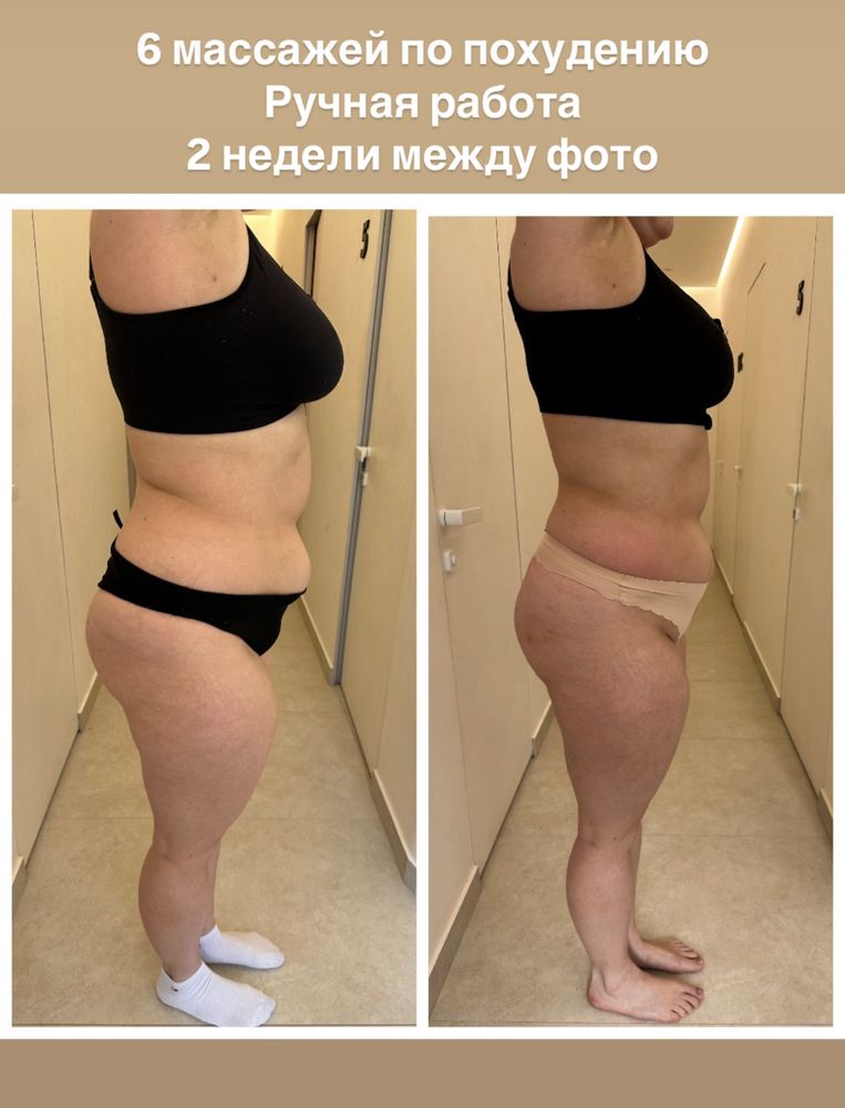 Майстер масажу, Аркадія