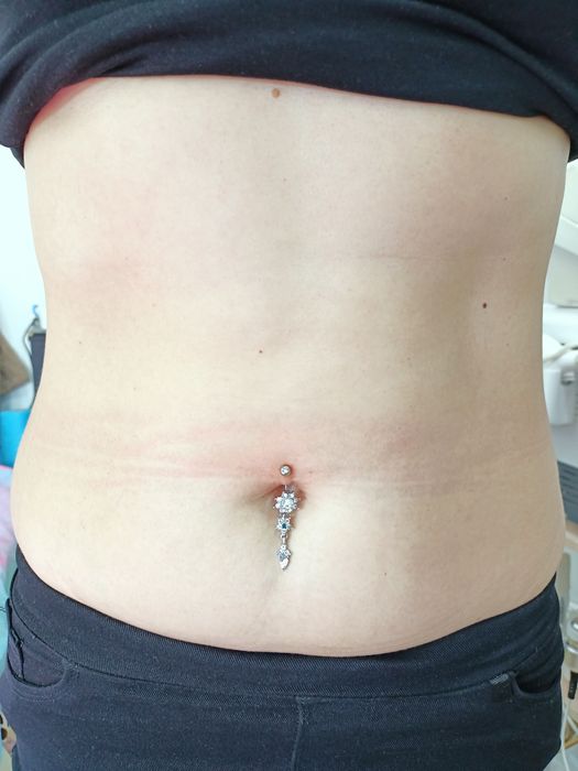 Косметолог, Біоревіталізація, Ботокс, Контурна пластика , мезотерапія.