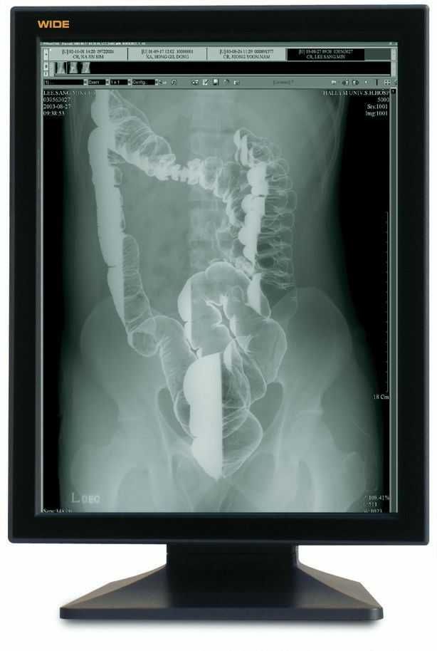 Monitor Monocromático de Diagnóstico Médico/Xray Wide PG21HQX IF2303M