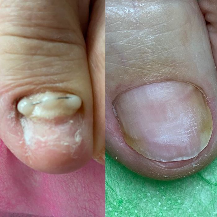 Подолог. Медичний педикюр