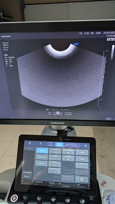 Аппарат УЗИ, УЗД Samsung HS40