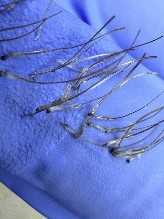 Електроепіляція навчання!