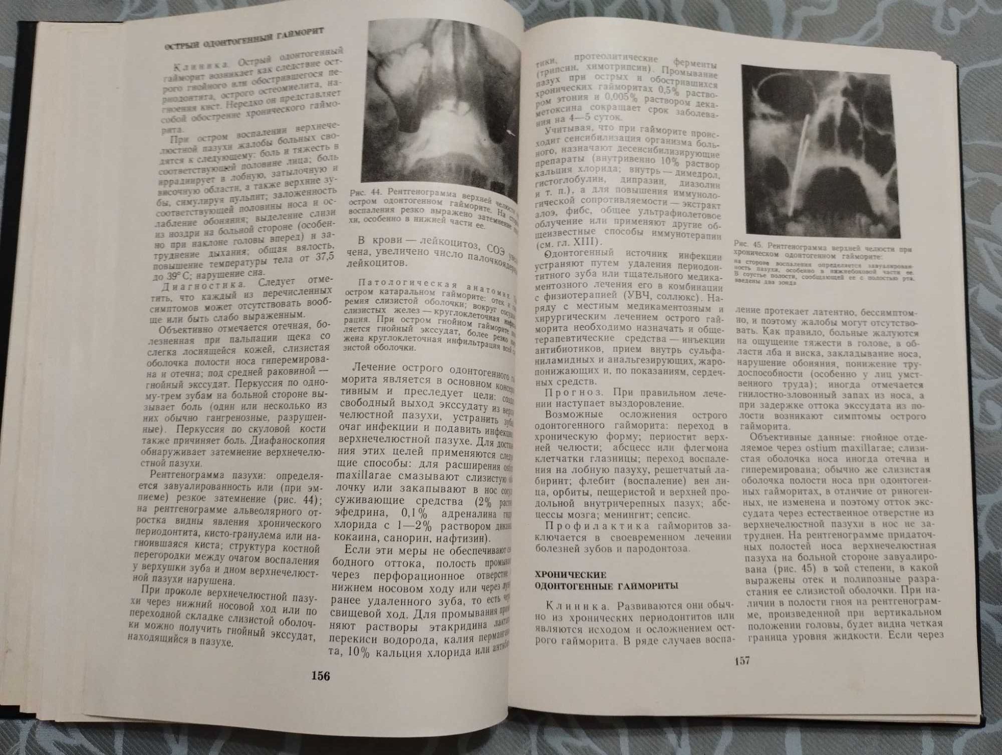 " Основы хирургической стоматологии" Ю. И. Бернадский 1983 год.