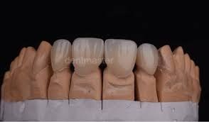 Зубний Технік…..