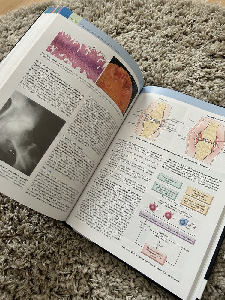 Основи патології за Роббінсом переклад 10-го видання