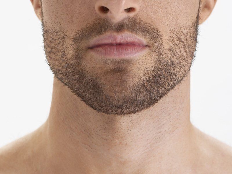 NEW ORIGINAL Minox 5% Засіб для росту волосся та бороди 60ml