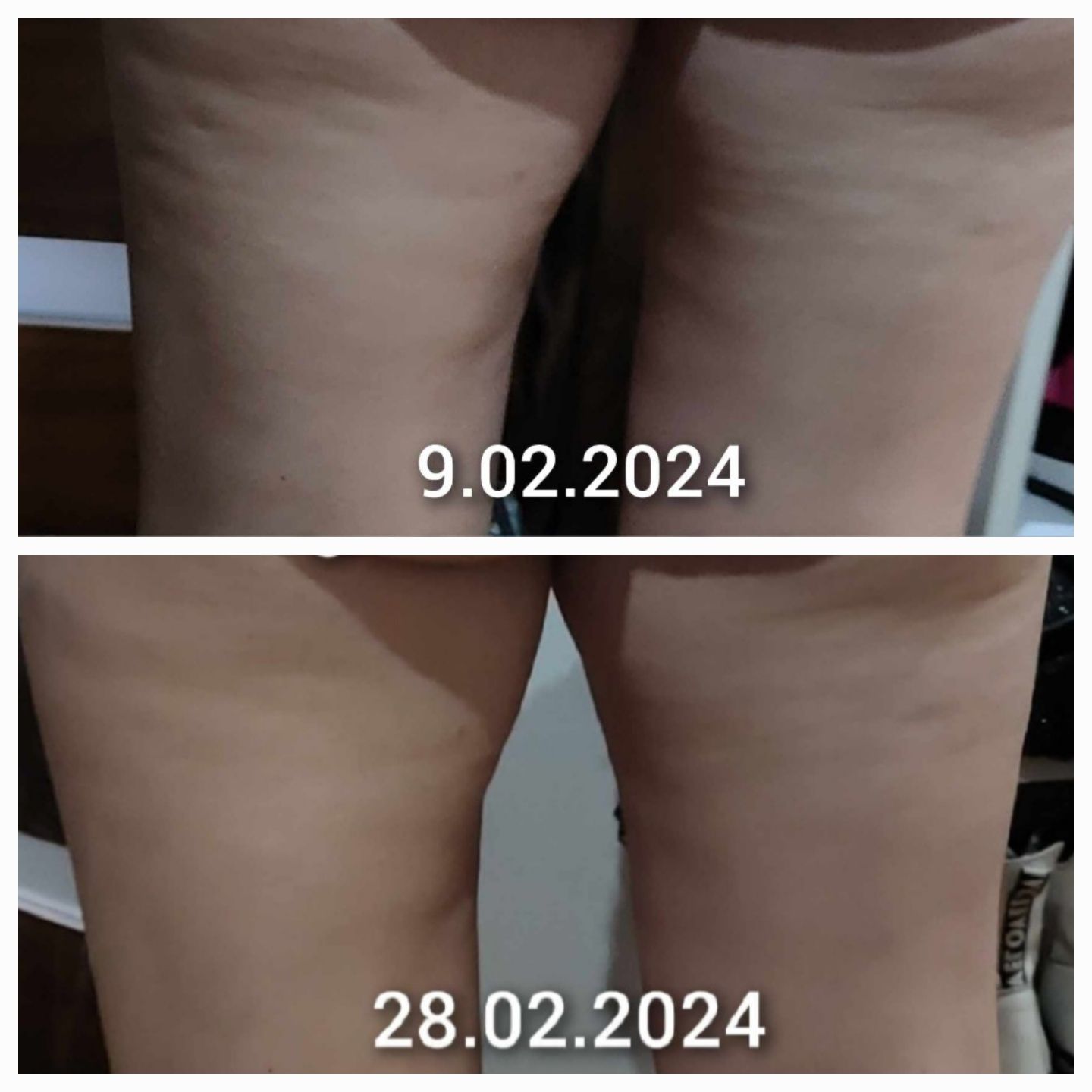 Pogromca cellulitu, Suplement diety FM World Nutricode Cellufight