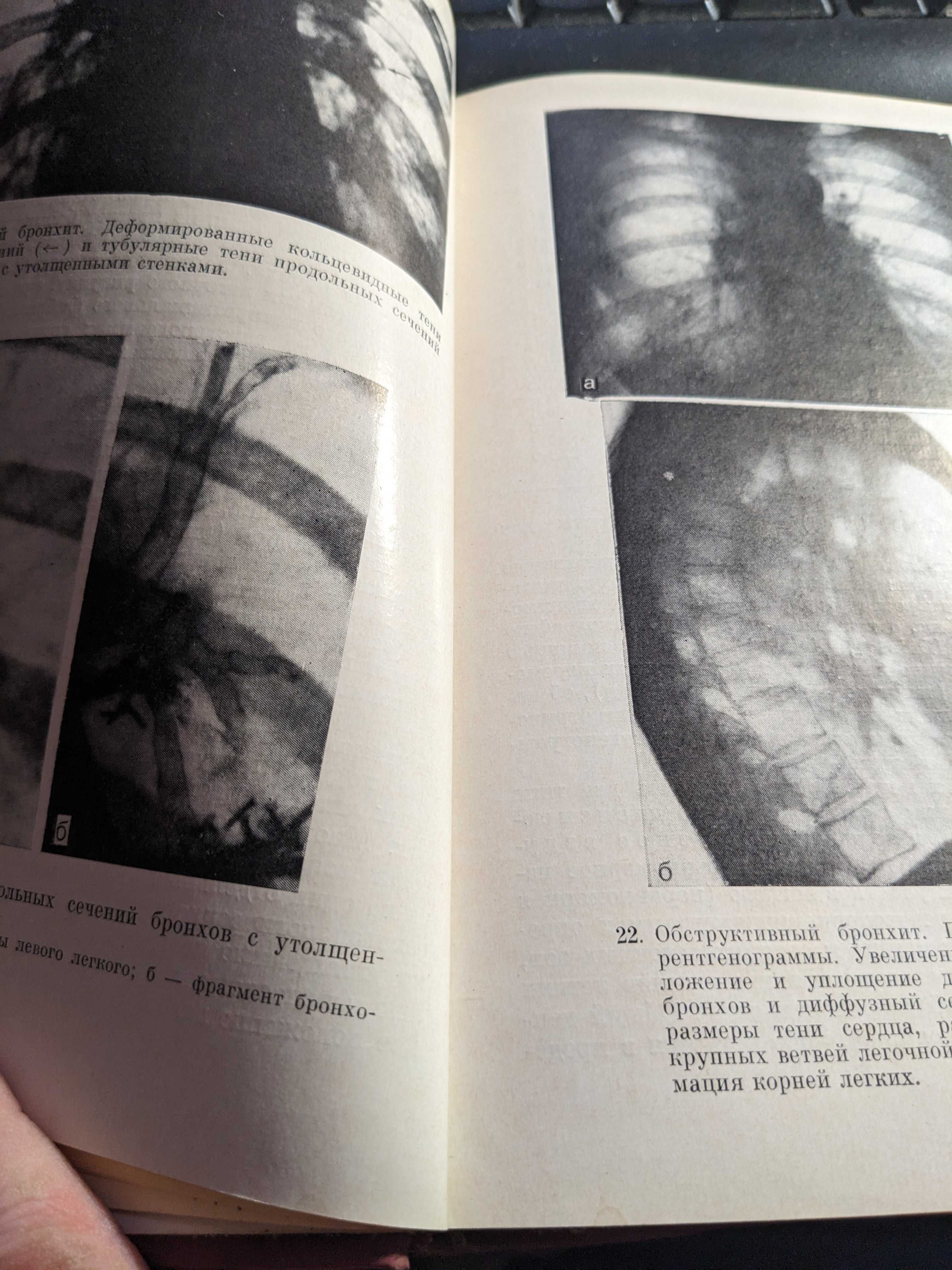 Книга клінічна Рентген -Радіологія