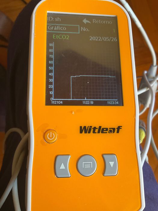 CAPNÓGRAFO COM OXÍMETRO. Medidor de Dióxido de Carbono e Oxigénio.