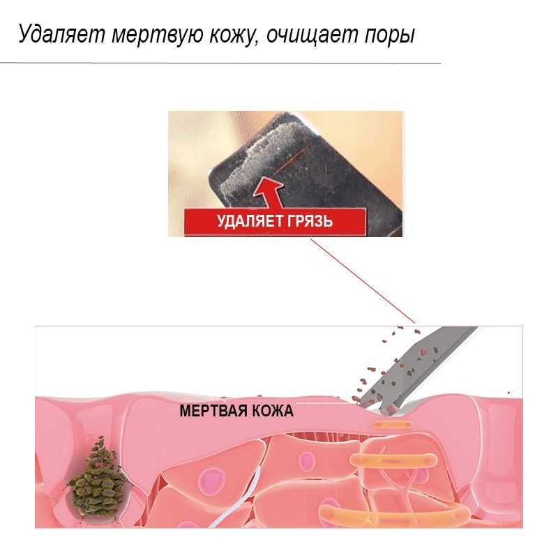 Ультразвуковий скрабер Ultrasonic Acne Cleanser для шкіри обличчя