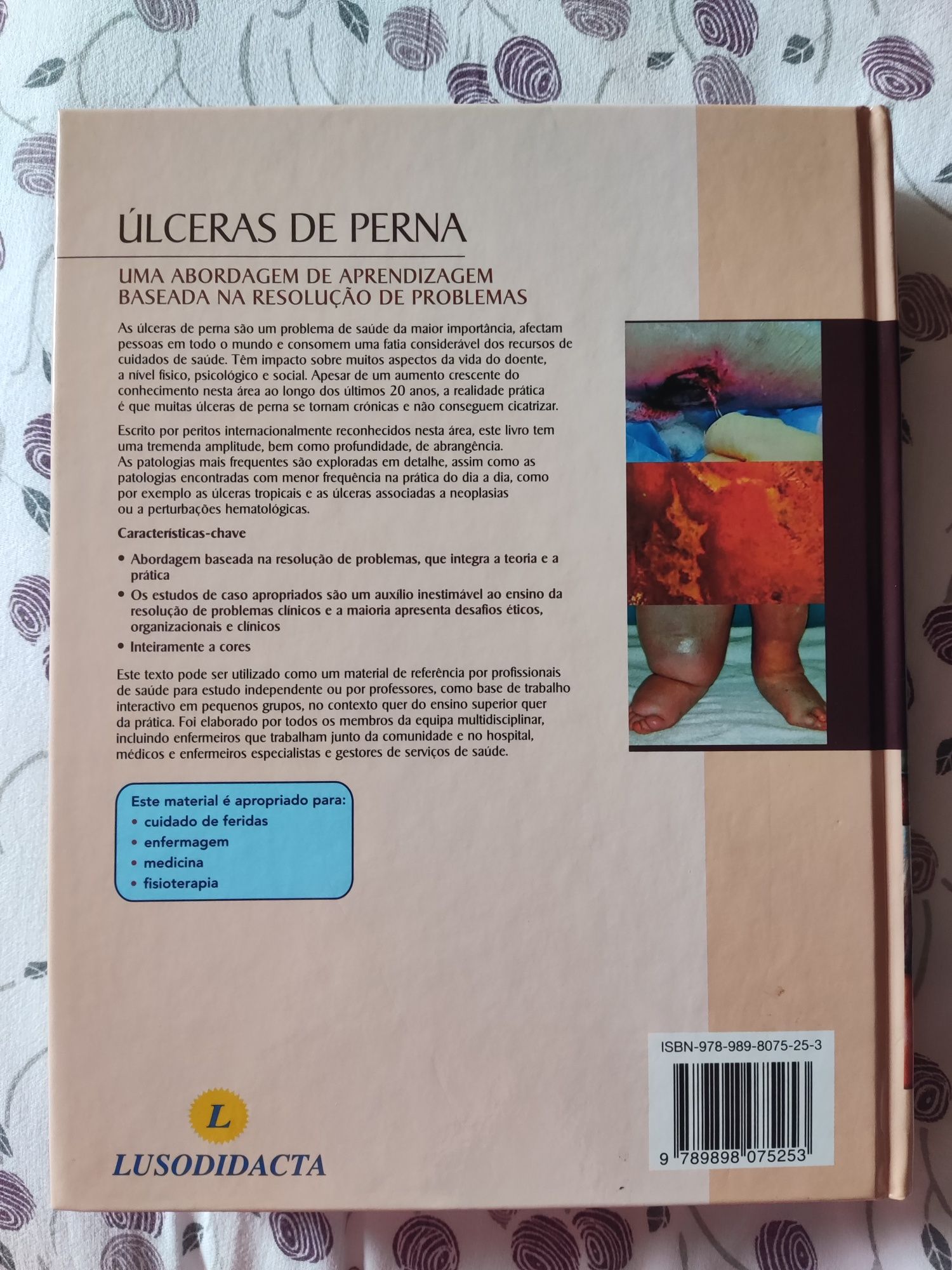 Úlceras de perna