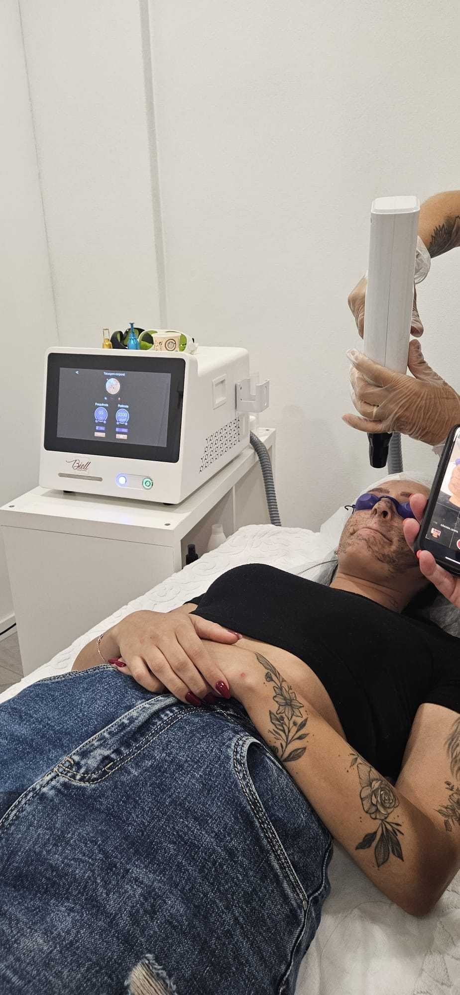 Depilação a laser, remoçao de tatuagem e peeling com valor justo