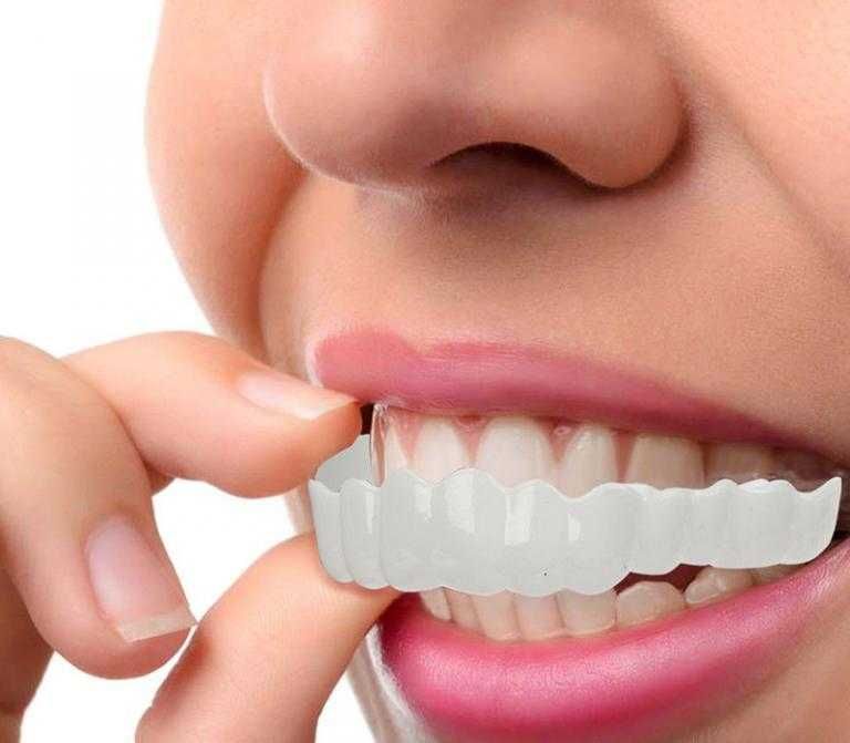 Виниры каппы для зубов SNAPON SMILE