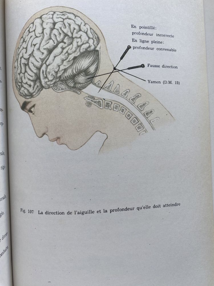 Livro “ Precis d’acupuncture chinoise”