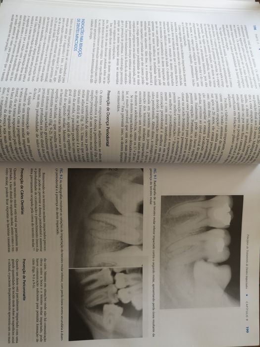 Cirurgia oral e maxilofacial. Peterson