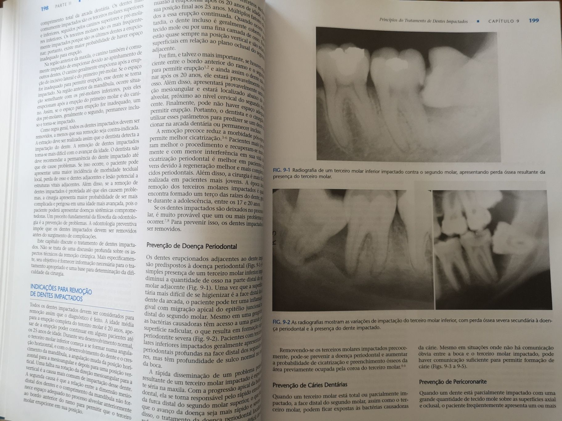 Cirurgia oral e maxilofacial. Peterson