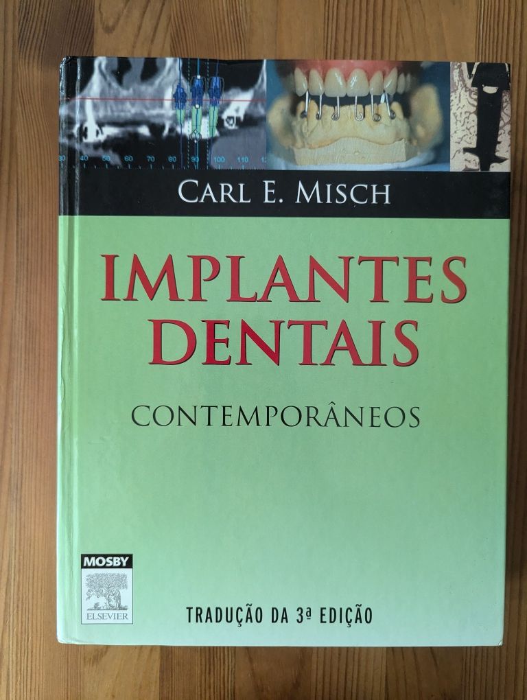 Livro Implantes Dentais Contemporâneos - Carl E. Misch - 3°edição
