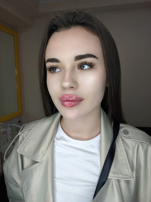 Модель на контурну пластику губ, скули Джолі, ботокс