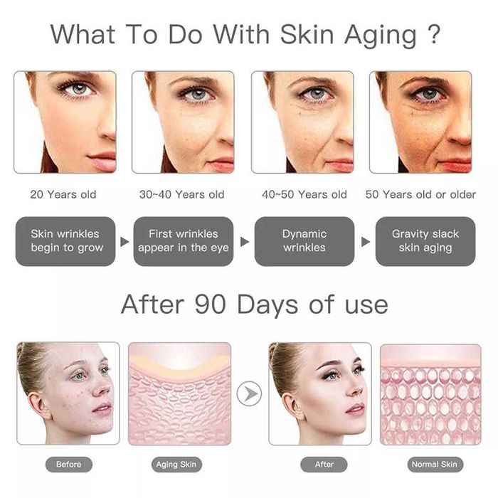 MINI HIFU 3º TERCEIRA GERAÇÃO ORIGINAL USO DOMESTICO