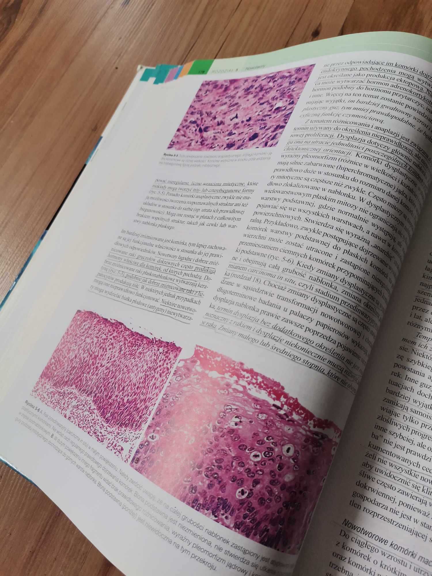 Robbins Patologia