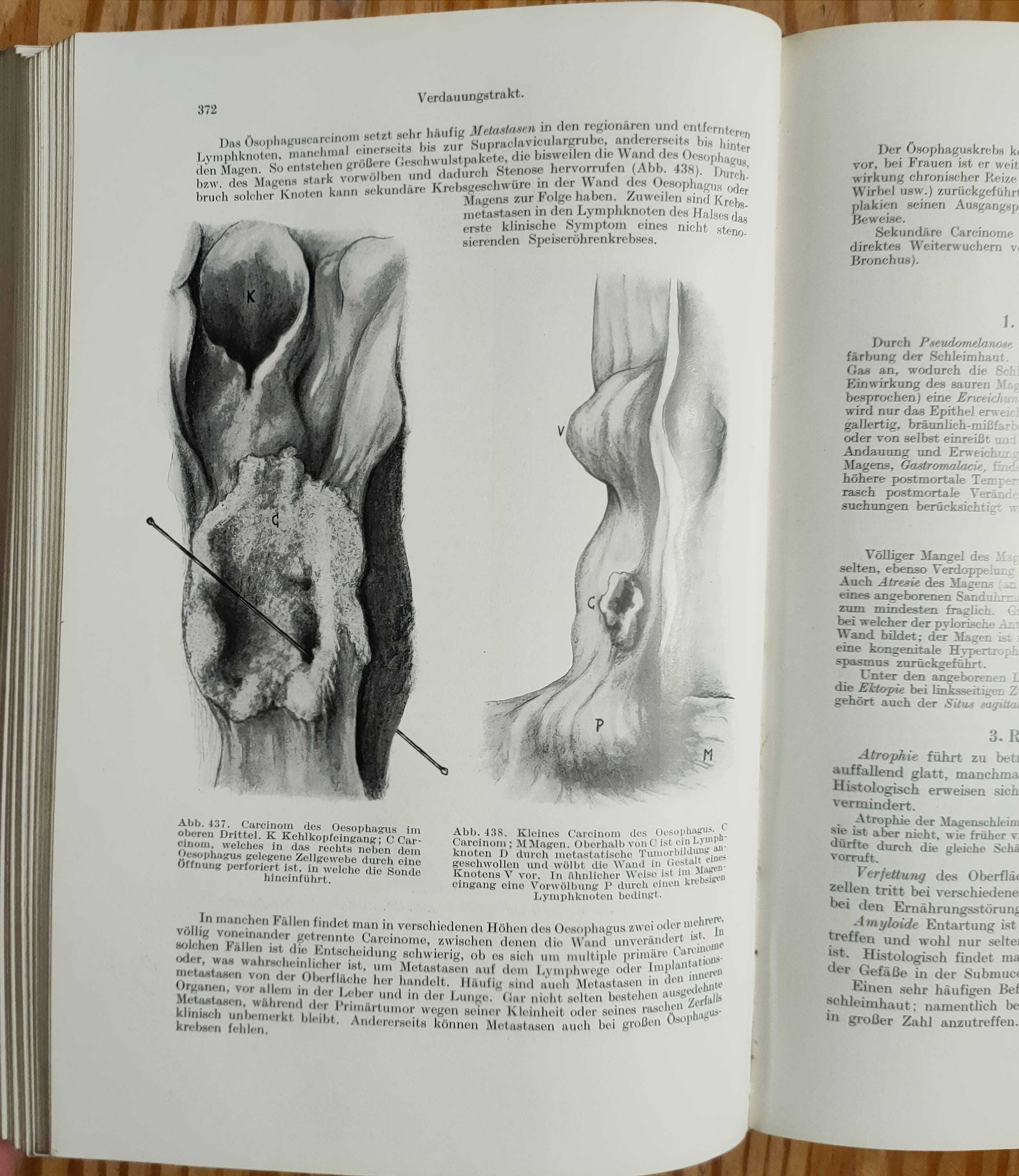 Lehrbuch der allgemeinen pathologie und der pathologischen anatomie