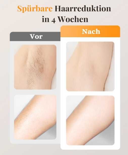 IPL Laser Depilator do Usuwania Włosów D-1189