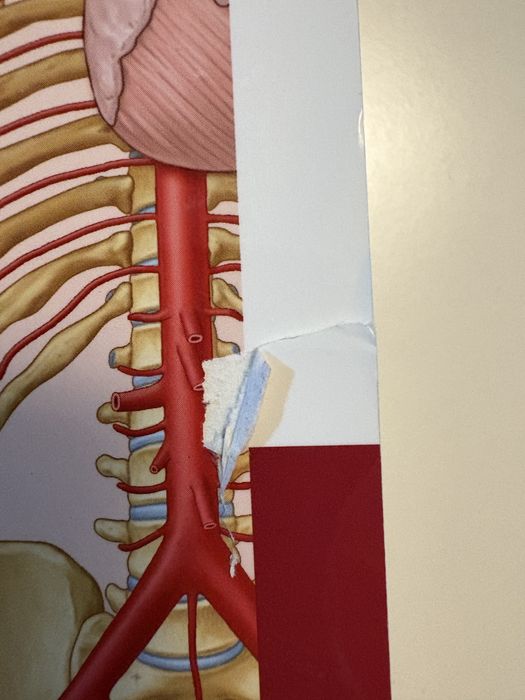 Anatomia kliniczna Moore tom 1+2 (komplet) NOWA