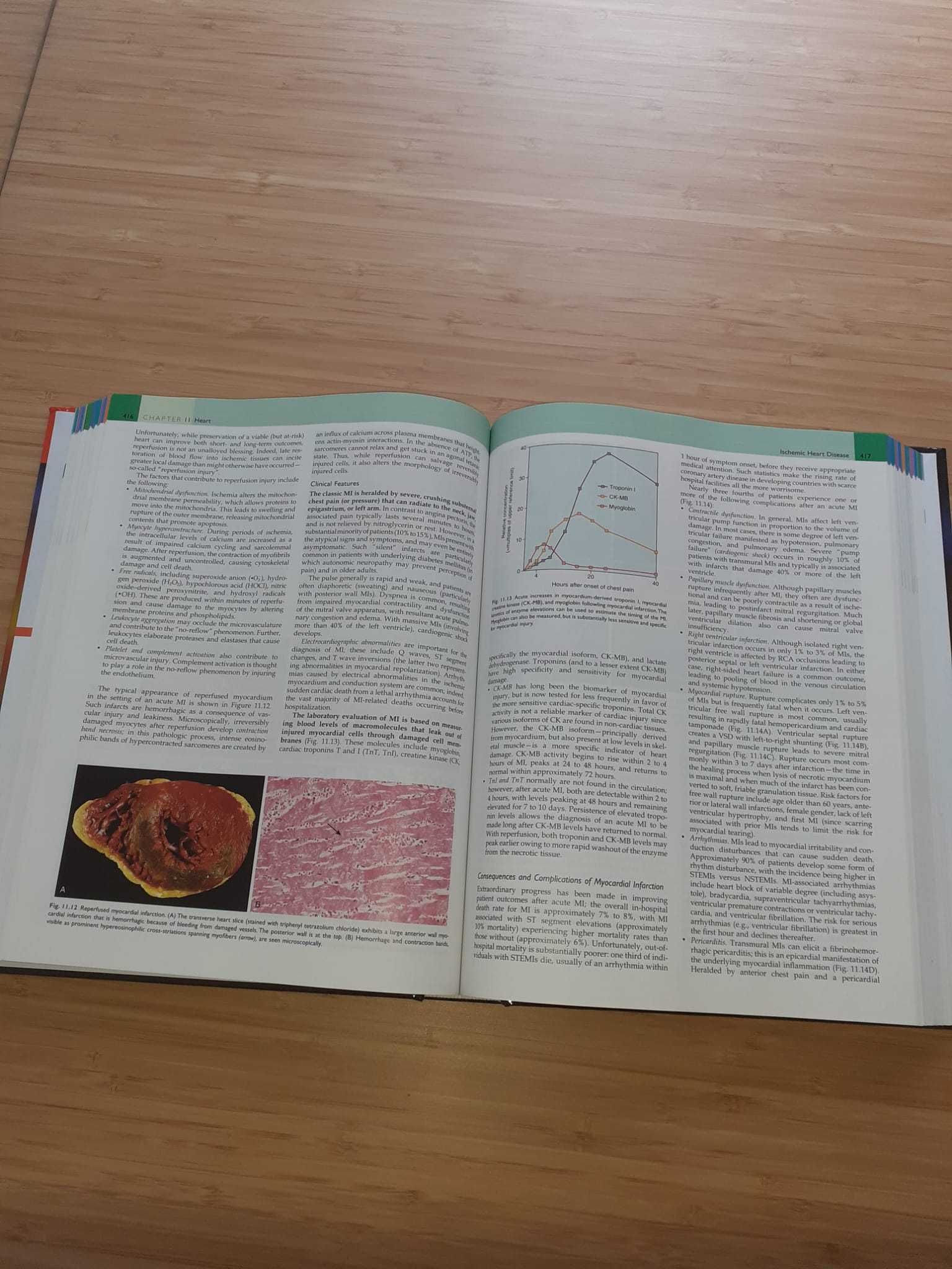 Robbins Basic Pathology, 10th Edition