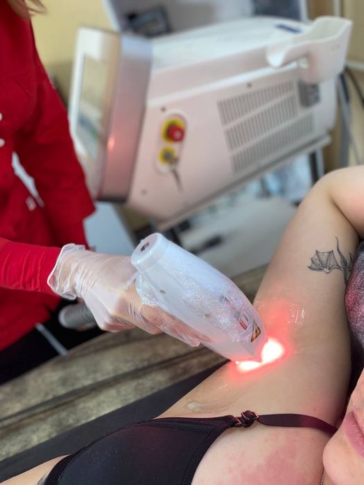 Шугаринг Воскова депіляція Запоріжжя центр