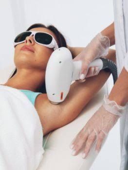 Лазерна епіляція