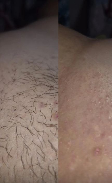 Шугаринг, Воскова депіляція ( чоловіча та жіноча)Інгульський район