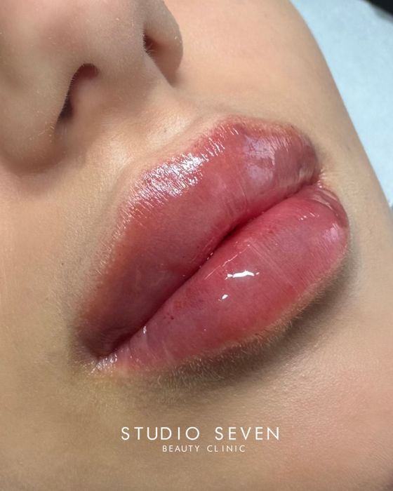 Powiekszanie ust, powiększanie ust