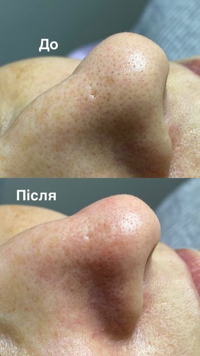 Послуги Косметолога