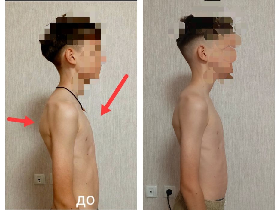 Остеопат, лечение мышечной боли.