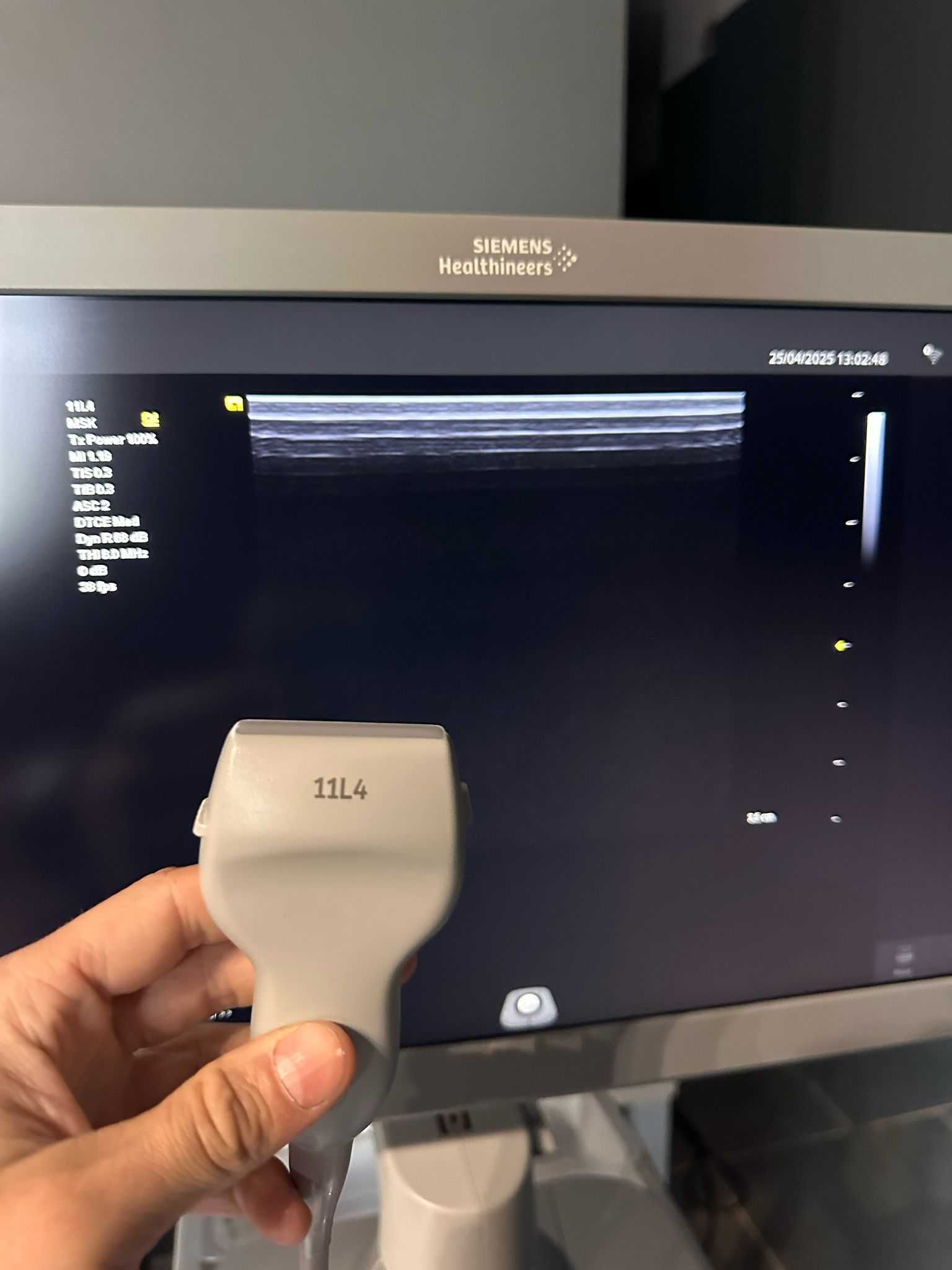 USG Siemens Acuson Juniper z głowicą