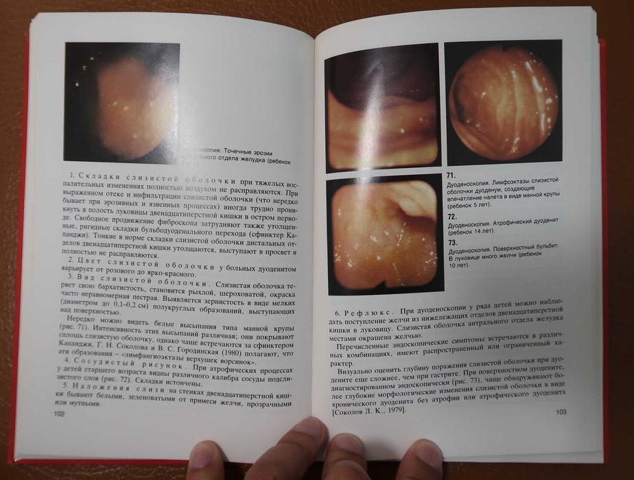 Эндоскопия учебник атлас ЖКТ Долецкий купить