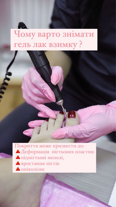Подолог Харків, Центр. Подологічний педікюр