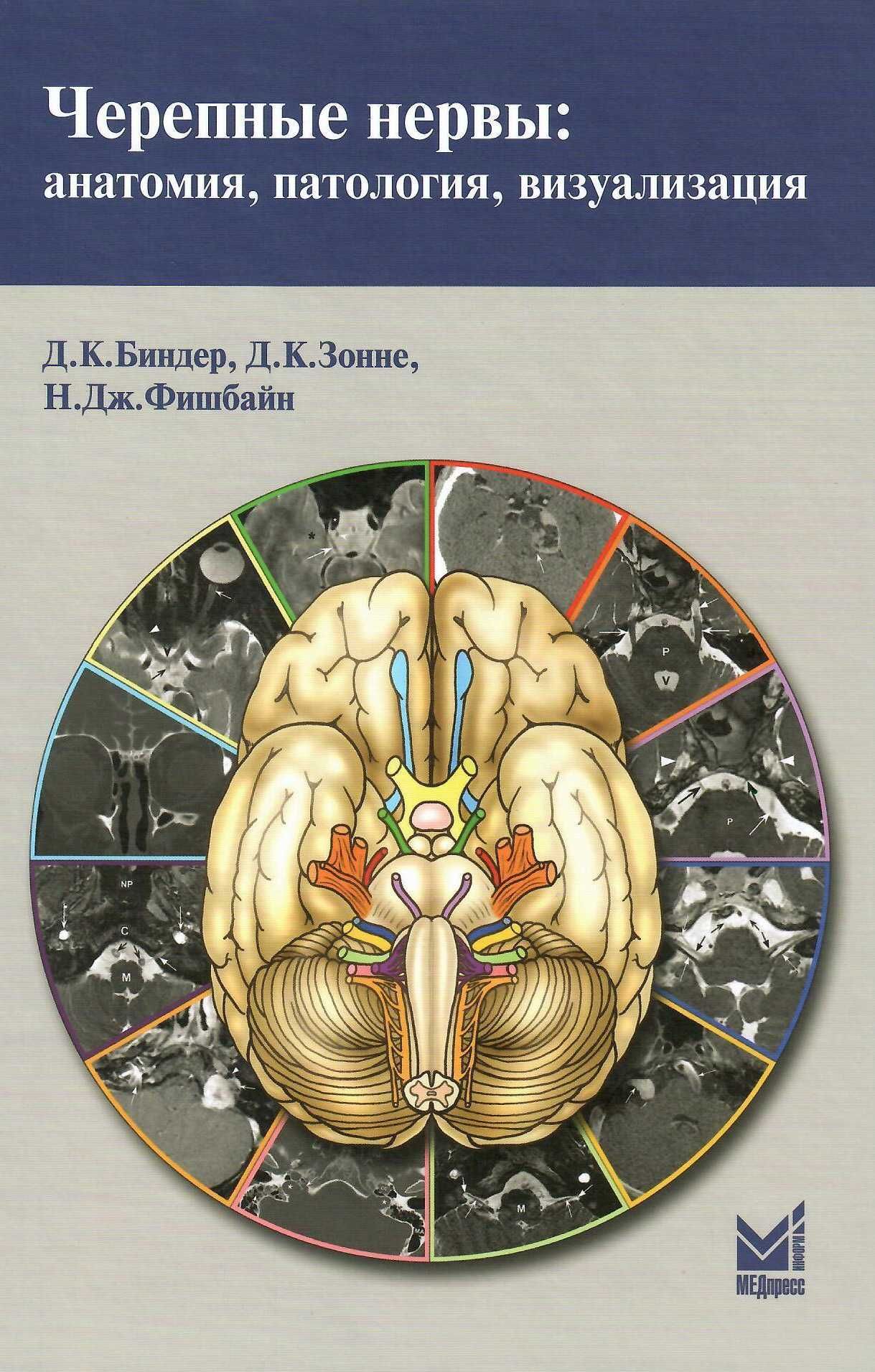 Черепные нервы анатомия, патология, визуализация  Д.К. Биндер 2014 г