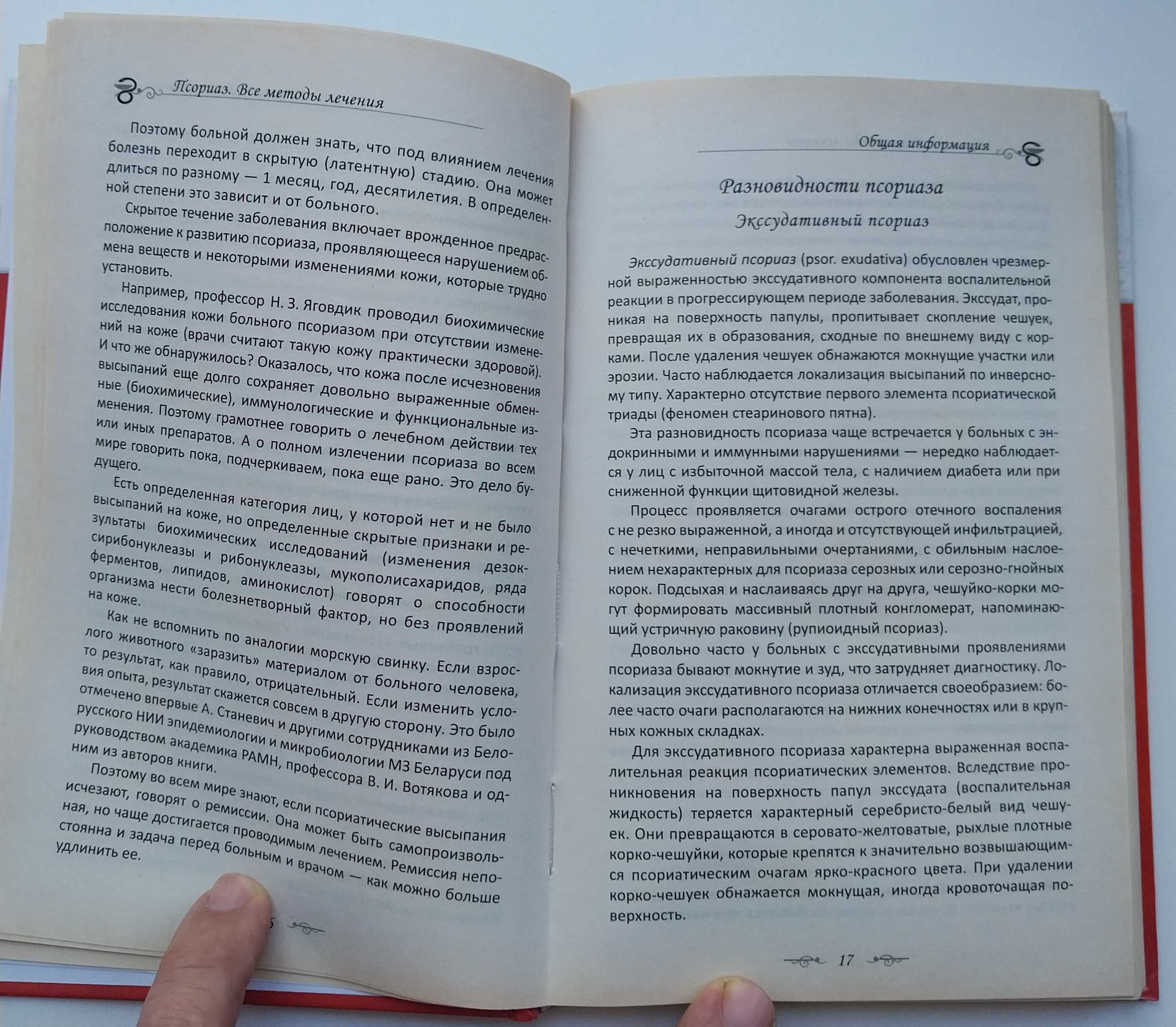 Псориаз Все методы лечения Васильева Я.В.Харьков 2013, 256с Тираж 5 т.