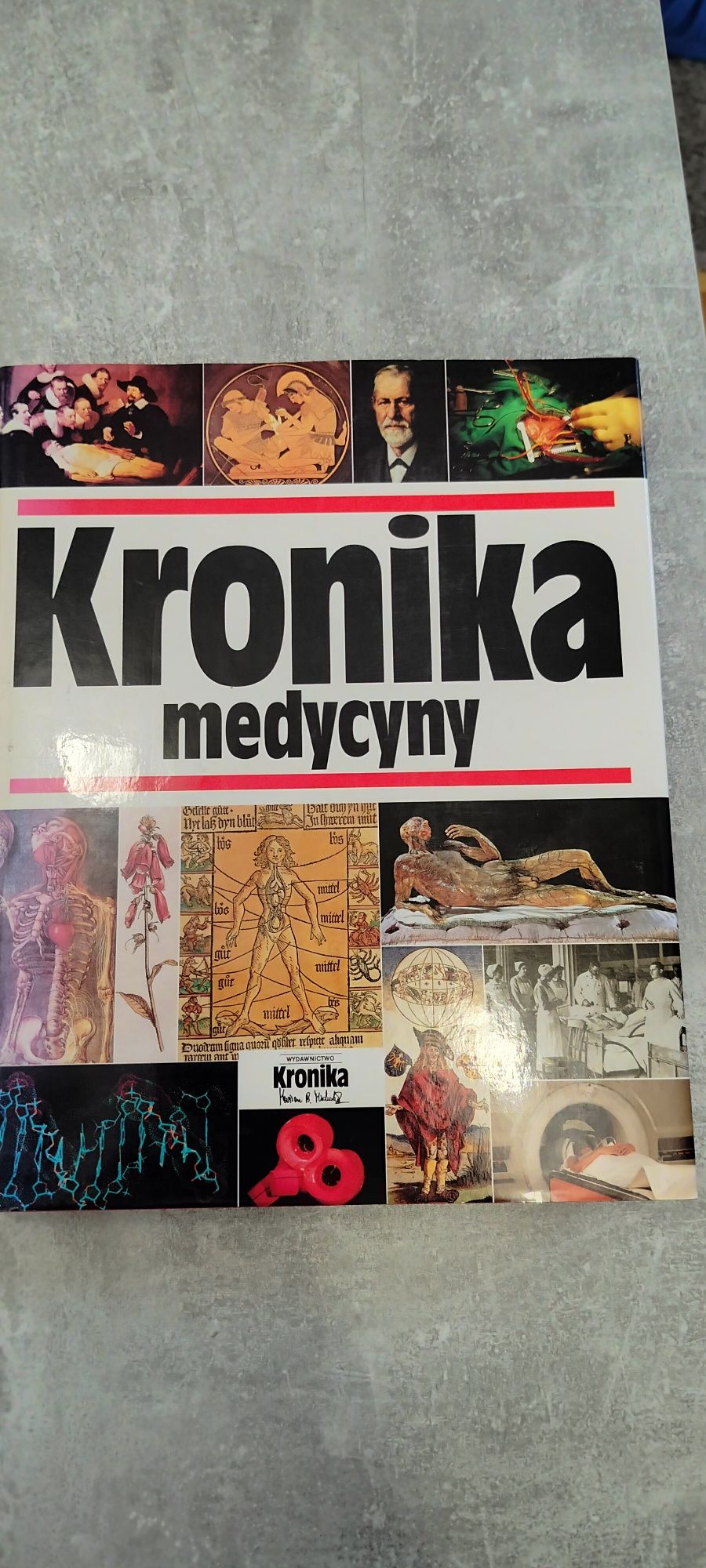 Kronika medycyny