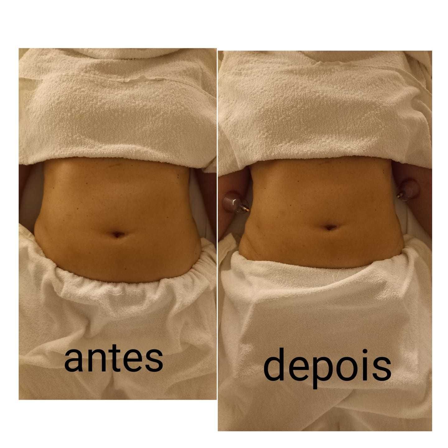 Pressoterapia+oferta gel e calças