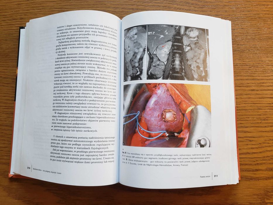 Nadciśnienie tętnicze - Andrzej Januszewicz. Wyd. IV - Kraków 2007