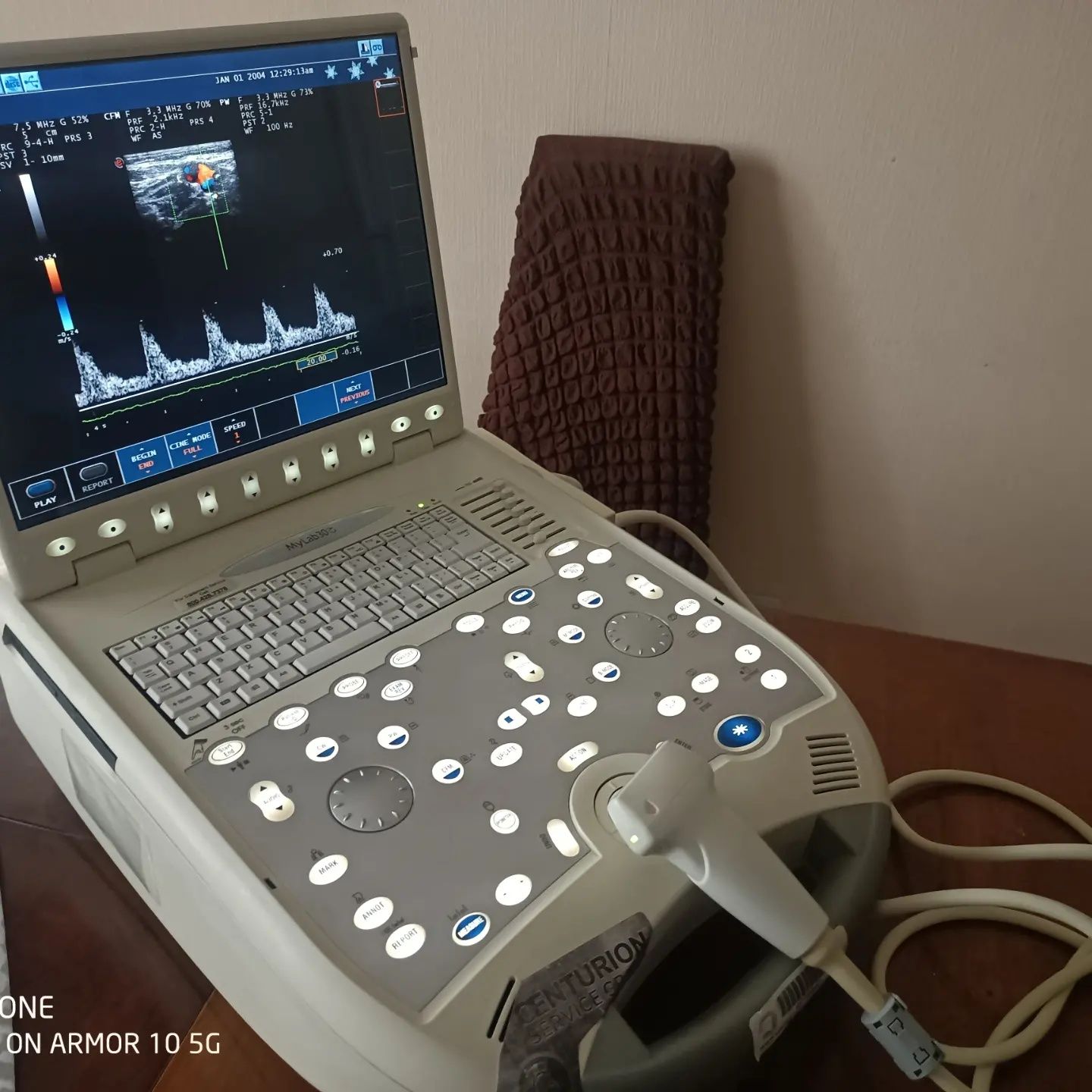 Портативний узд апарат Esaote my lab 30 cv CARDIO УЗИ 2009 р.в.