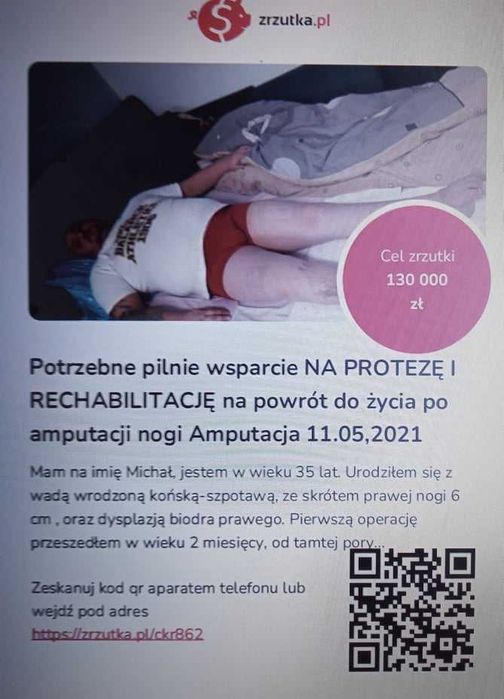 Michałowi grozi amputacja! Pomóż! Pilnie potrzebna pomoc!! Cegiełka 20