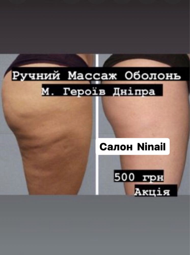 Антицелюлітний  масаж Оболонь! 500гр/45хв. Антицелюлітний моделюючий