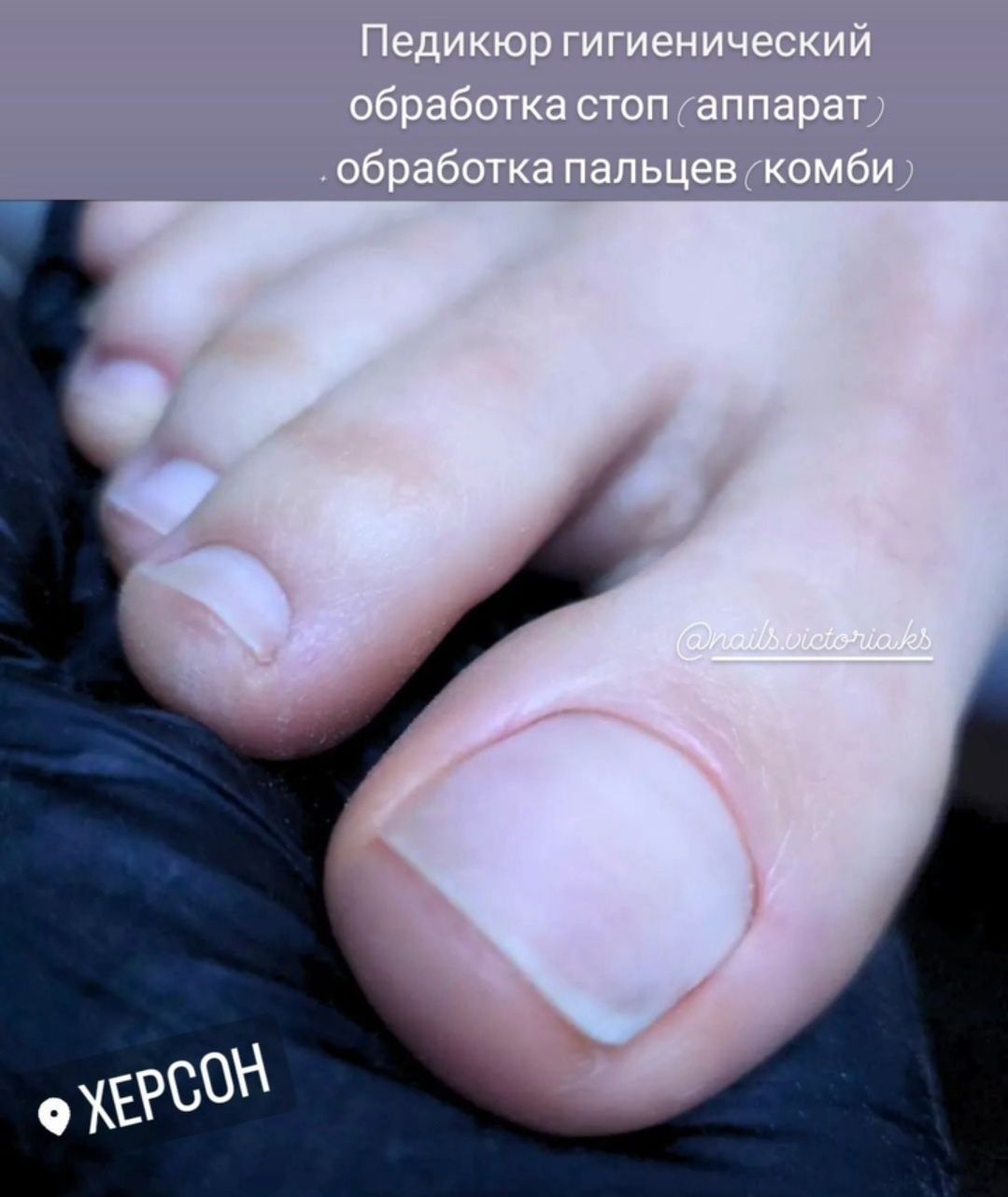 Педикюр гигиенический, педикюр гель-лак