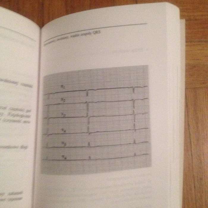 Od EKG do diagnozy