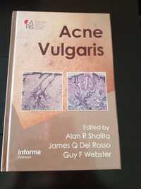 Livro "Acne Vulgaris"